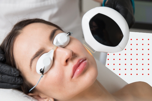 Скидка 25% на фотомоложение и фототерапию Lumecca